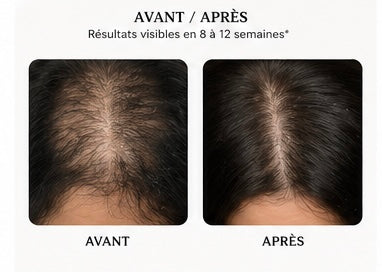 Spray pousse cheveux/ anti-chute Pouss’boost