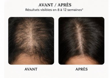 accelerateurdepousse - pouss’boostSpray pousse cheveux/ anti - chute Pouss’boost