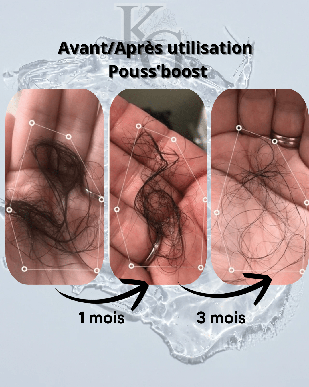 accelerateurdepousse - pouss’boostSpray pousse cheveux/ anti - chute Pouss’boost